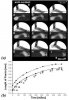 The In Vivo Elastic Properties of the Plantar Fascia During the Contact Phase of Walking 1.jpg