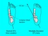 Anterior tibial tendon-STJ axis PPT.jpg
