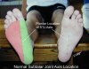 Normal STJ Axis on Plantar Foot.Without Labels.jpg